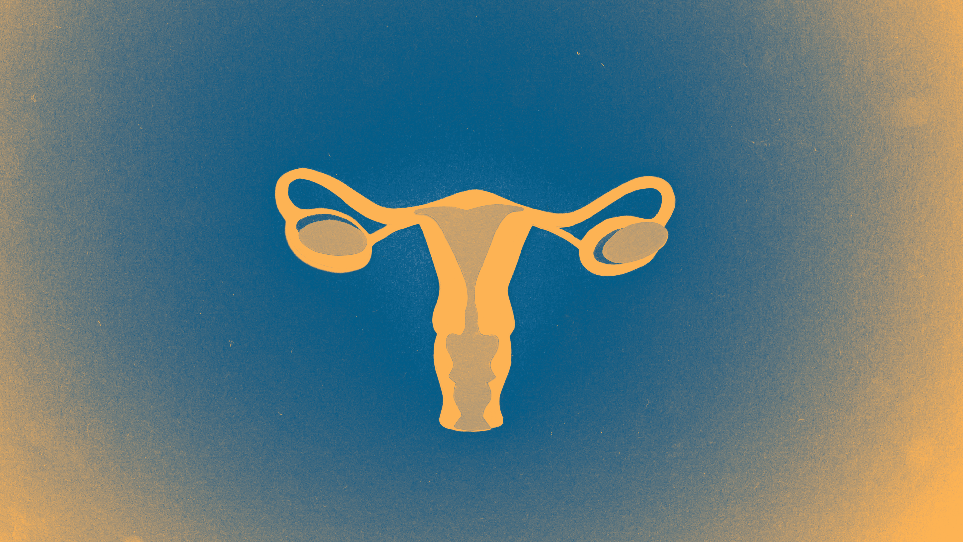 Potential Texas ordinance drives conversation about abortion laws on Reddit